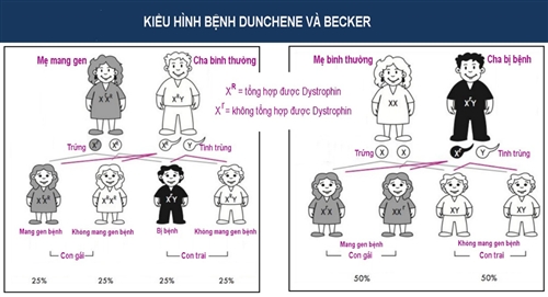 duchenne-va-becker.jpg